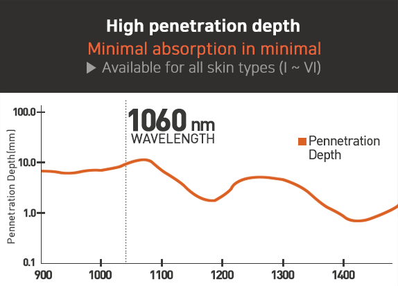 1060nm Wavelength Laser