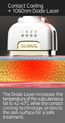 How SLIMUS Works
